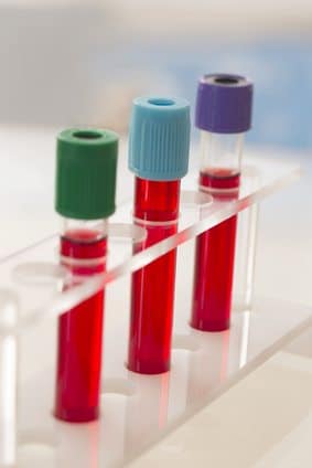 tubes de sang sur support