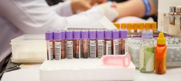 Le Chocolat Peut Il Augmenter Les Gamma Gt Augmentation des Gamma GT : comment l'expliquer ? | La santé surtout