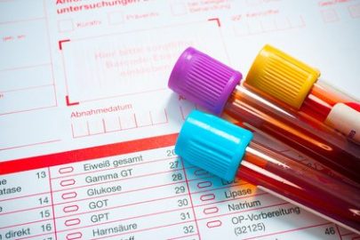 Test sanguin - Laboratoire médical