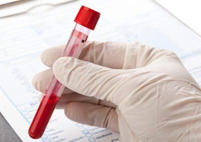 Fiabilité du test VIH: 4 ou 6 semaines ? Par le Dr Jean-Marc Bohbot