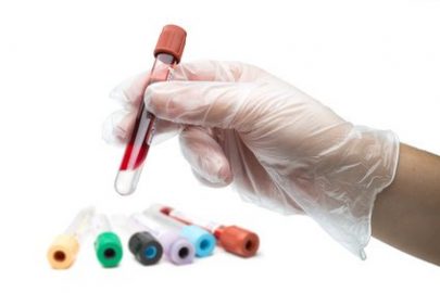 Test sanguin - Tube à essai