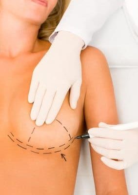 Seins qui tombent : que faire ? 