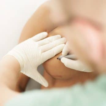 Augmentation mammaire, remboursée par la sécu ? Par Dr Gonnelli