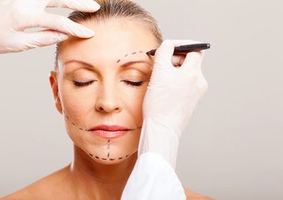 Lifting du visage : le cou aussi ? par Dr David Gonnelli