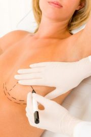 Chirurgie - Chirurgie plastique