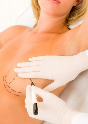 Asymétrie mammaire : que peut-on faire ? Par Dr David Gonnelli