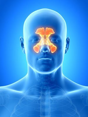 Polypes des sinus : on opère ou pas ? Par Dr Michel Hanau