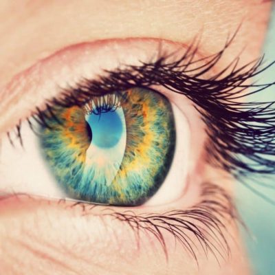 Qu'est ce qu'une hyperpigmentation de l'iris ? Par Dr Marc Timsit