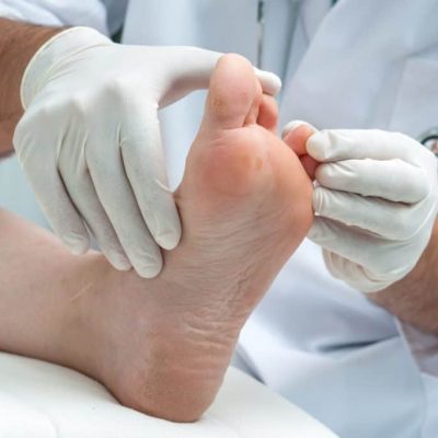 Comment traiter l'eczéma au niveau des pieds ? Par le Dr Éric Poitrine