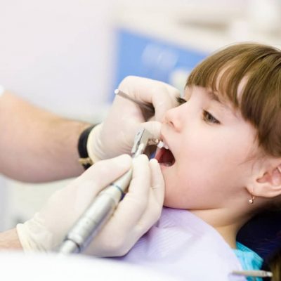 Le fluor provoque t-il des taches définitives sur les dents ? Par le Dr Nathalie Andreu