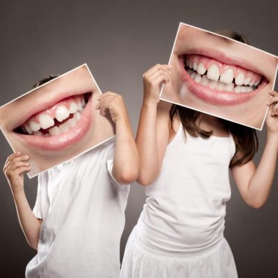 Traitement orthodontique : risque de taches blanches sur les dents ? 