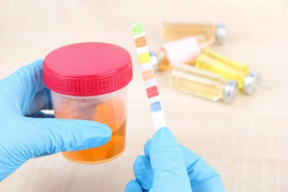 Bandelette de test d'urine - Tests d'urine cliniques