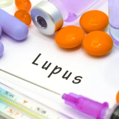 8 questions/réponses pour tout savoir sur le lupus, une maladie auto-immune