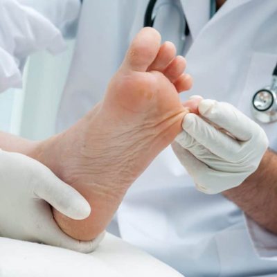 Orteil cassé ? Faut-il aller aux urgences ? Par le Dr Kevin Boulenger