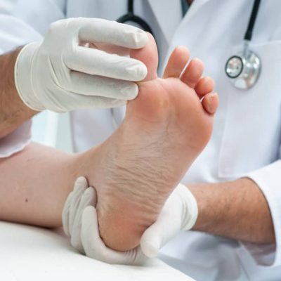 Hallux valgus : reprise de la marche et du sport 