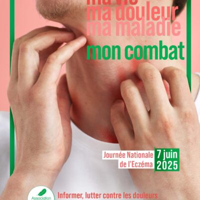 Eczéma : une souffrance physique et une menace pour la santé mentale de l’adulte et de l’enfant. 